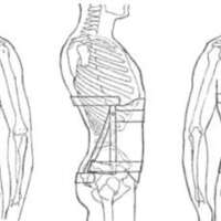 http://www.oandplibrary.org/al/images/1970_02_049/tmp649-3.jpg
