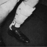 http://www.oandplibrary.org/cpo/images/1980_03_003/1980_03_003-3.jpg