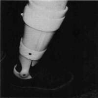 http://www.oandplibrary.org/cpo/images/1980_03_003/1980_03_003-4.jpg