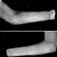 http://www.oandplibrary.org/al/images/1967_01_001/1967_01_001-07.jpg