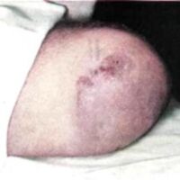 http://www.oandplibrary.org/al/images/1956_01_020/sp56-b009.jpg