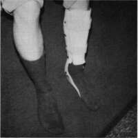 http://www.oandplibrary.org/cpo/images/1980_03_003/1980_03_003-2.jpg