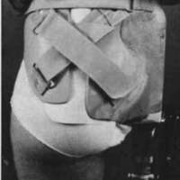 http://www.oandplibrary.org/cpo/images/1981_01_006/1981_01_006-2.jpg