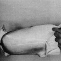 http://www.oandplibrary.org/cpo/images/1987_02_101/1987_02_101-6.jpg