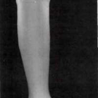 http://www.oandplibrary.org/al/images/1970_01_057/tmp39A-18.jpg