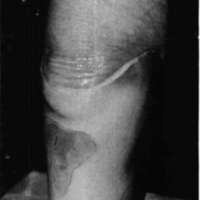 http://www.oandplibrary.org/cpo/images/1986_03_101/1986_03_101-2.jpg