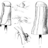 http://www.oandplibrary.org/al/images/1962_02_025/tmp62D-13.jpg