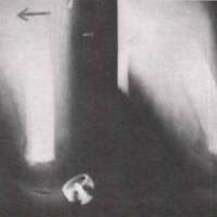 http://www.oandplibrary.org/al/images/1968_02_028/1968_02_028-04.jpg