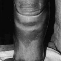 http://www.oandplibrary.org/cpo/images/1986_03_101/1986_03_101-4.jpg