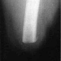 http://www.oandplibrary.org/cpo/images/1984_01_009/1984_01_009-2.jpg