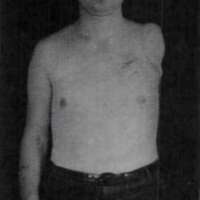 http://www.oandplibrary.org/al/images/1970_01_001/1970_01_001-17.jpg