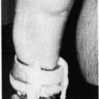 http://www.oandplibrary.org/cpo/images/1985_03_013/1985_03_013-08.jpg