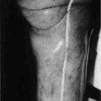 http://www.oandplibrary.org/cpo/images/1986_03_101/1986_03_101-3.jpg