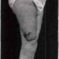 http://www.oandplibrary.org/al/images/1957_01_041/1957-Spring-47.jpg