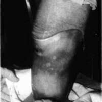 http://www.oandplibrary.org/cpo/images/1986_03_101/1986_03_101-5.jpg