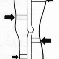 http://www.oandplibrary.org/cpo/images/1984_02_004/1984_02_004-02.jpg