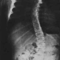 http://www.oandplibrary.org/cpo/images/1981_01_001/1981_01_001-4.jpg