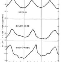 http://www.oandplibrary.org/al/images/1954_03_047/tmp3B8-18.jpg