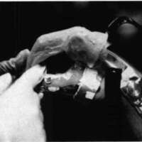 http://www.oandplibrary.org/cpo/images/1986_03_115/1986_03_115-2.jpg
