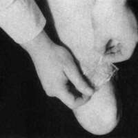 http://www.oandplibrary.org/cpo/images/1987_03_109/1987_03_109-3.jpg