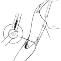 http://www.oandplibrary.org/al/images/1954_01_015/Jan54c-015.jpg