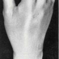 http://www.oandplibrary.org/al/images/1954_01_015/Jan54c-002.jpg