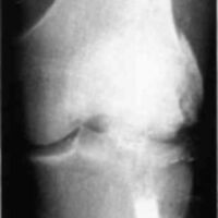 http://www.oandplibrary.org/cpo/images/1985_02_007/1985_02_007-04.jpg