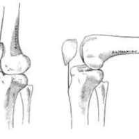 http://www.oandplibrary.org/al/images/1962_02_004/tmp623-10.jpg