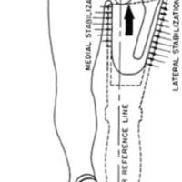 http://www.oandplibrary.org/al/images/1955_01_035/1955-JanuaryOCRBatchc-23.jpg