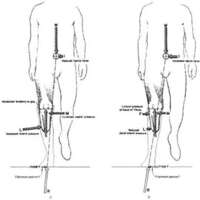 http://www.oandplibrary.org/al/images/1962_02_016/tmp624-4.jpg