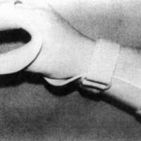 http://www.oandplibrary.org/cpo/images/1987_04_201/1987_04_201-04.jpg