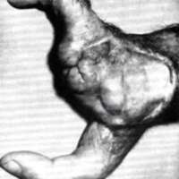 http://www.oandplibrary.org/al/images/1968_01_014/spring68b-01.jpg