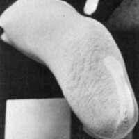 http://www.oandplibrary.org/al/images/1970_01_057/tmp39A-03.jpg