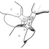 http://www.oandplibrary.org/al/images/1954_03_004/tmp1C6-13.jpg
