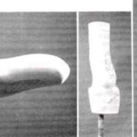 http://www.oandplibrary.org/al/images/1966_02_005/aut66-2-11.jpg