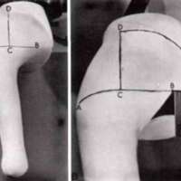 http://www.oandplibrary.org/al/images/1971_01_027/1971_01_027-20.jpg