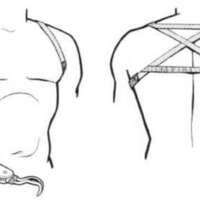 http://www.oandplibrary.org/al/images/1955_03_026/tmp48A-17.jpg