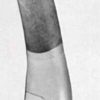 http://www.oandplibrary.org/al/images/1970_01_065/tmp39B-10.jpg