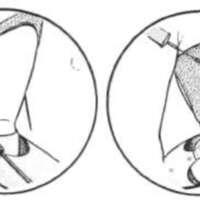 http://www.oandplibrary.org/al/images/1955_03_026/tmp48A-6.jpg