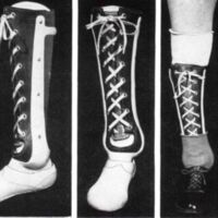 http://www.oandplibrary.org/al/images/1961_01_052/c007.jpg