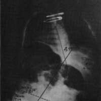 http://www.oandplibrary.org/cpo/images/1986_04_137/1986_04_137-05.jpg