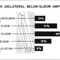 http://www.oandplibrary.org/al/images/1958_01_057/tmp4F8-13.jpg