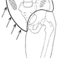 http://www.oandplibrary.org/al/images/1964_01_003/1964_01_003-02.jpg