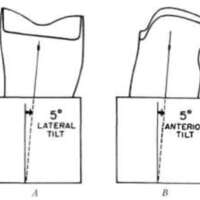 http://www.oandplibrary.org/al/images/1962_02_025/tmp62D-20.jpg