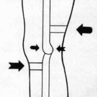 http://www.oandplibrary.org/cpo/images/1984_02_004/1984_02_004-05.jpg