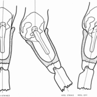 http://www.oandplibrary.org/cpo/images/1985_04_006/1985_04_006-3.jpg