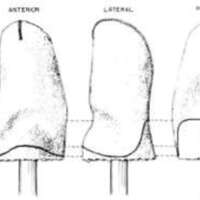 http://www.oandplibrary.org/al/images/1962_02_025/tmp62D-11.jpg