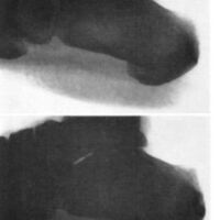 http://www.oandplibrary.org/al/images/1961_01_004/a016.jpg