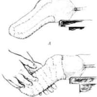 http://www.oandplibrary.org/al/images/1962_02_025/tmp62D-02.jpg