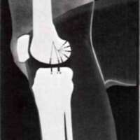 http://www.oandplibrary.org/al/images/1969_02_031/69autumn-01.jpg